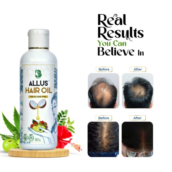 hair-fall-treatment-oil-allus-hair-oil