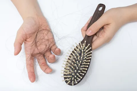 Blogs 8 Common Causes of Hair Loss and How to Address Them
